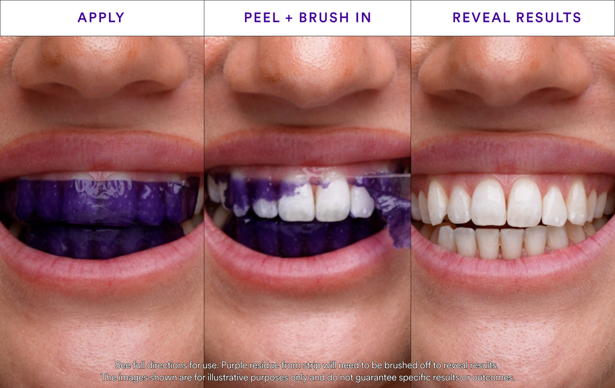 V34 Whitening Strips